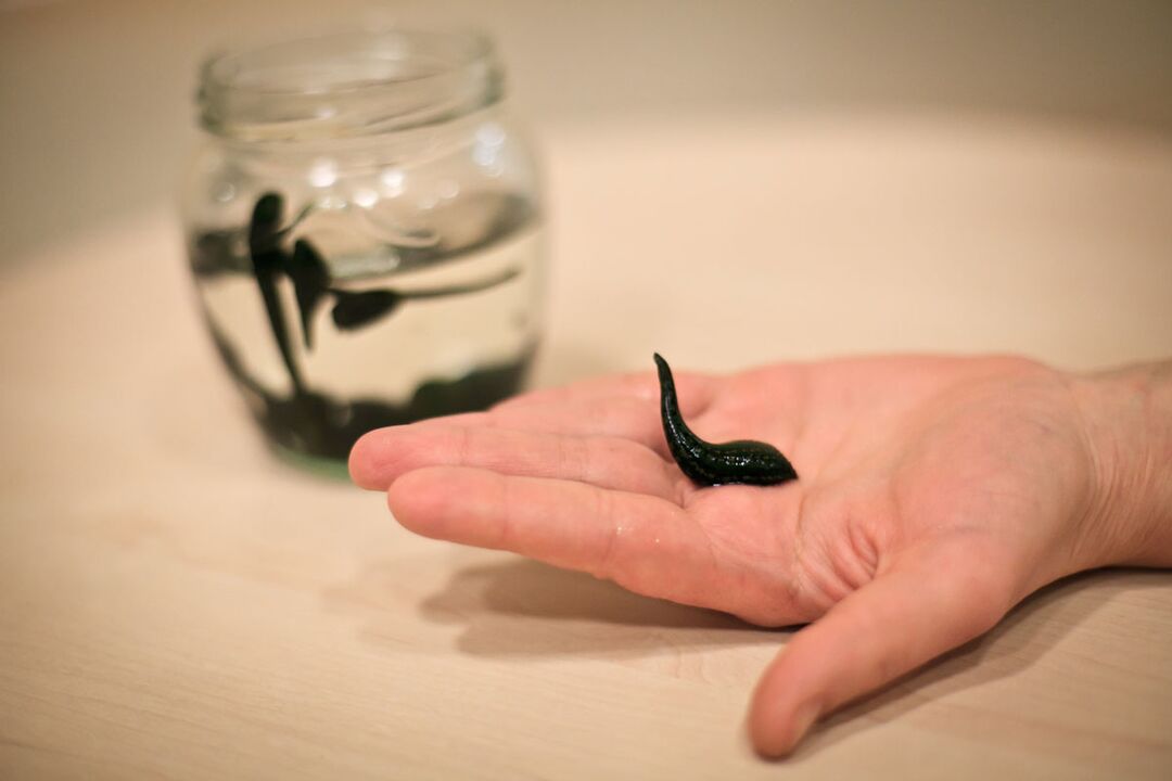 Leeches will be raw materials to produce a cream that stimulates penis growth